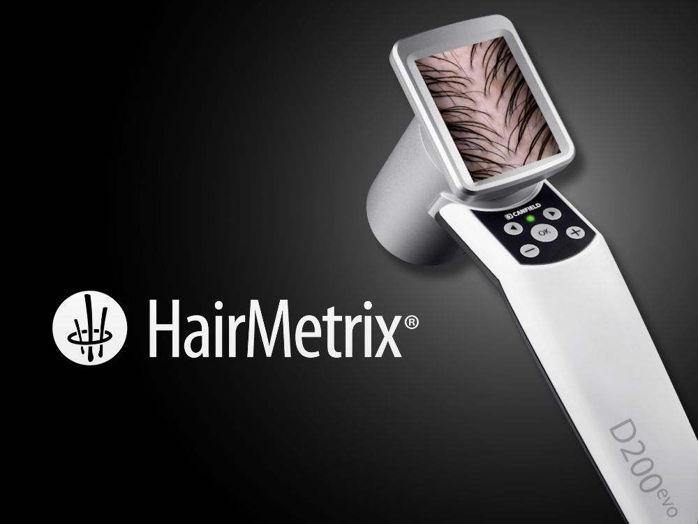 hairmetrix-vignette-solution
